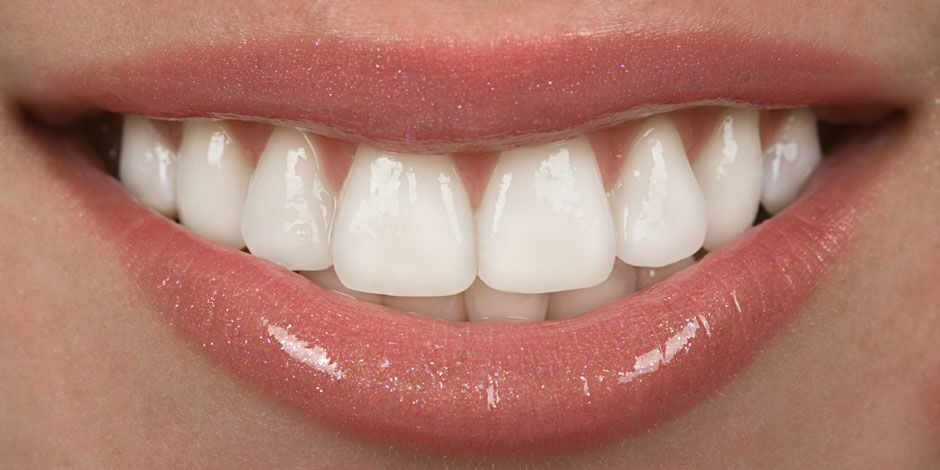 Cosmetic Veneers